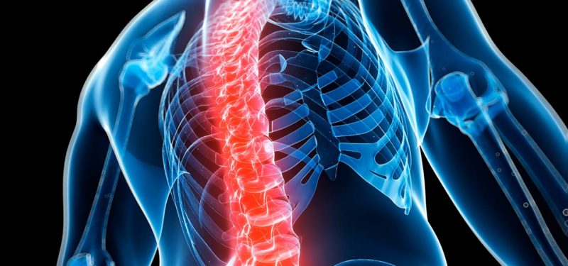 osteoporose prevenção